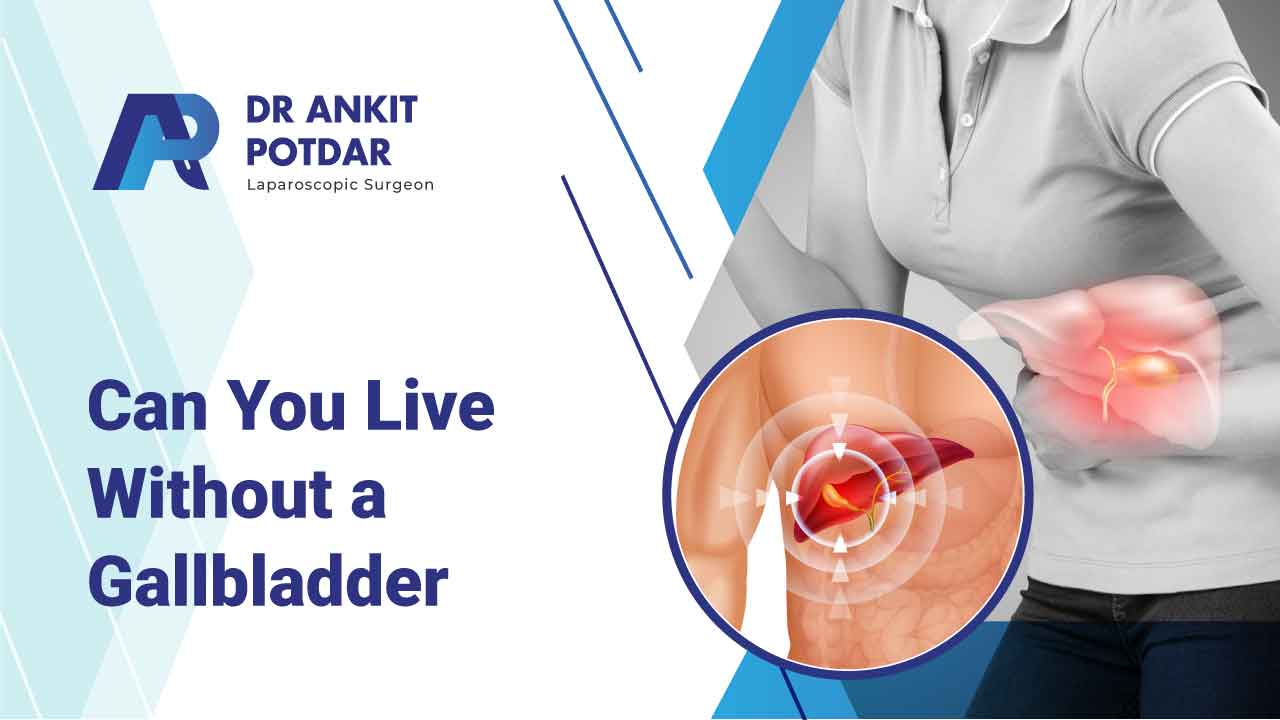 can you Live without Gallbladder